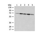 ACSF2 Polyclonal Antibody