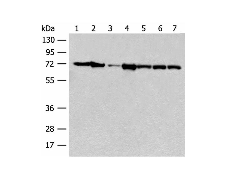HSPA2 Polyclonal Antibody Reactivity Human