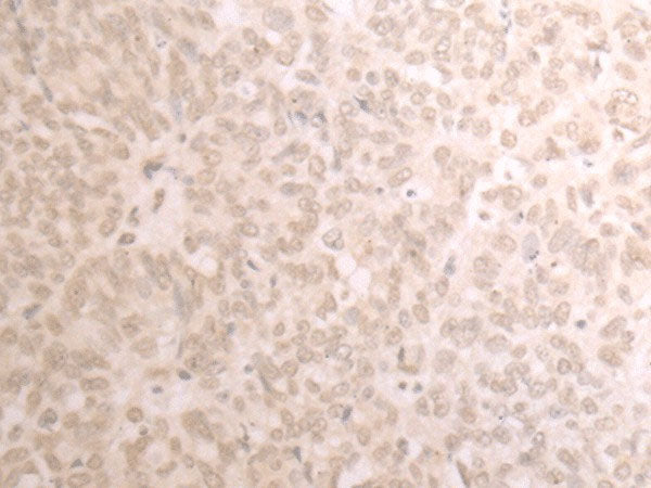TRMT1 Polyclonal Antibody Reactivity Human