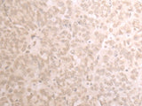 TRMT1 Polyclonal Antibody Reactivity Human