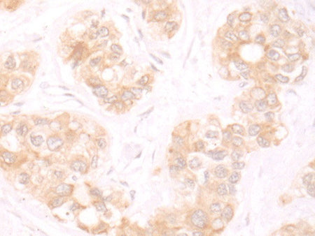 TRMT1 Polyclonal Antibody Reactivity Human