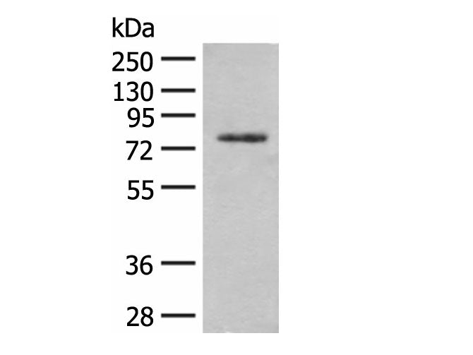 TRMT1 Polyclonal Antibody Reactivity Human