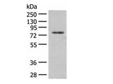 TRMT1 Polyclonal Antibody Reactivity Human