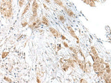 TCF25 Polyclonal Antibody Reactivity Human