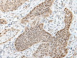 TCF25 Polyclonal Antibody Reactivity Human
