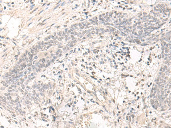 SAP130 Polyclonal Antibody Reactivity Human