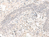 SAP130 Polyclonal Antibody Reactivity Human