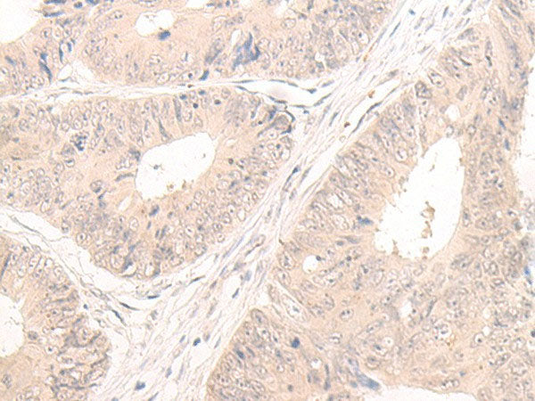 LCMT2 Polyclonal Antibody Reactivity Human