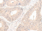 LCMT2 Polyclonal Antibody Reactivity Human
