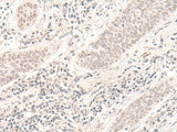 ZBED1 Polyclonal Antibody Reactivity Human