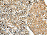 STT3A Polyclonal Antibody