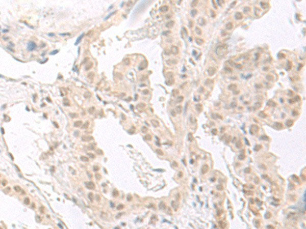 HOOK2 Polyclonal Antibody Reactivity Human