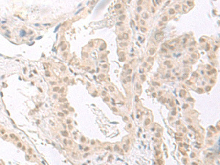 HOOK2 Polyclonal Antibody Reactivity Human