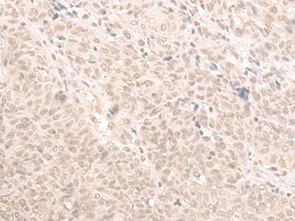 HOOK2 Polyclonal Antibody Reactivity Human