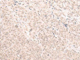 HOOK2 Polyclonal Antibody Reactivity Human