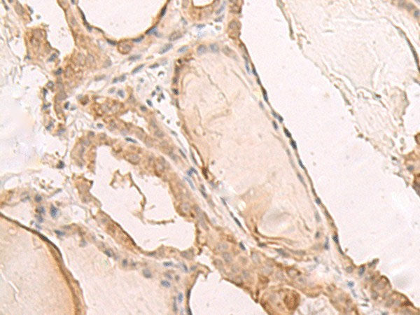 PBXIP1 Polyclonal Antibody Reactivity Human, Biomarkers, Elabscience Biotechnology, MSE Supplies