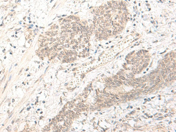 PBXIP1 Polyclonal Antibody Reactivity Human