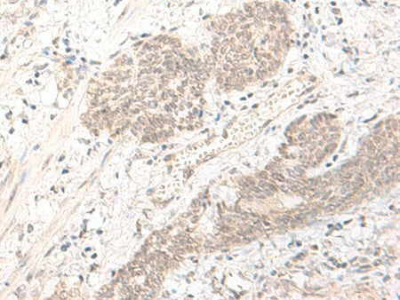 PBXIP1 Polyclonal Antibody Reactivity Human
