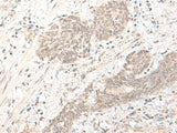 PBXIP1 Polyclonal Antibody Reactivity Human