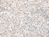 PFKM Polyclonal Antibody Reactivity Human