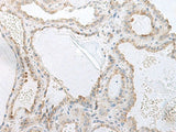 GPRASP2 Polyclonal Antibody
