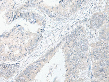 GPRASP2 Polyclonal Antibody