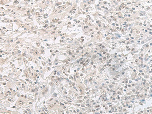 ORC1 Polyclonal Antibody