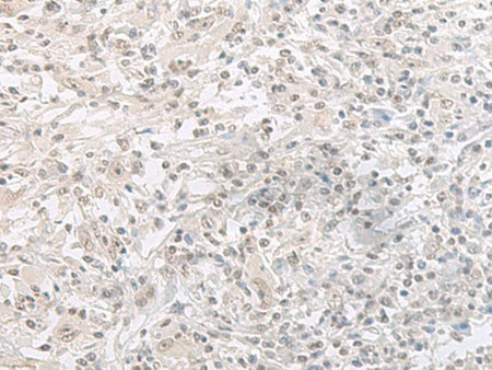 ORC1 Polyclonal Antibody