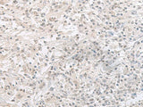 ORC1 Polyclonal Antibody