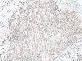 ORC1 Polyclonal Antibody
