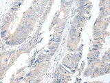 GBA2 Polyclonal Antibody Reactivity Human