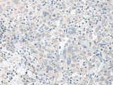 TIMM8A Polyclonal Antibody Reactivity Human