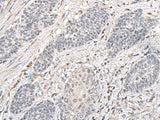 EPM2A Polyclonal Antibody Reactivity Human