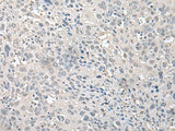 EPM2A Polyclonal Antibody Reactivity Human