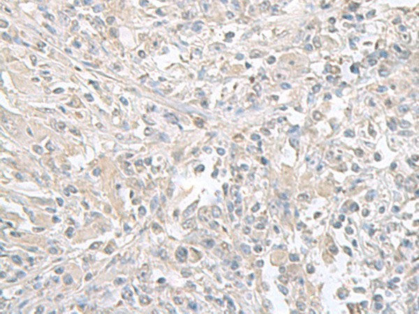 FXYD6 Polyclonal Antibody