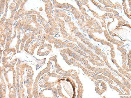 PLGLB2 Polyclonal Antibody Reactivity Human