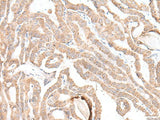PLGLB2 Polyclonal Antibody Reactivity Human