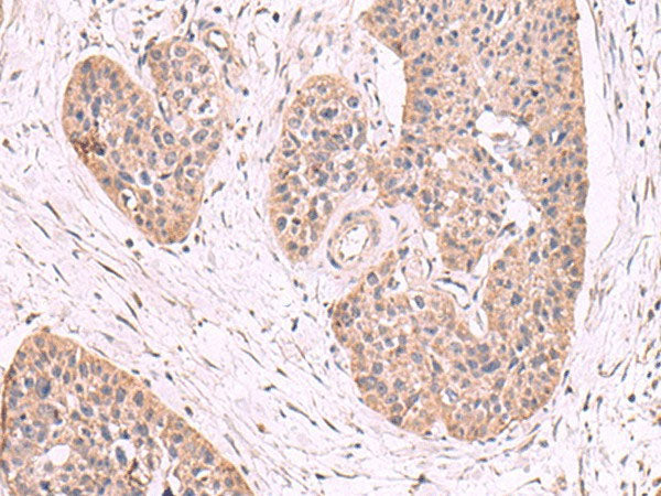 MGP Polyclonal Antibody Reactivity Human