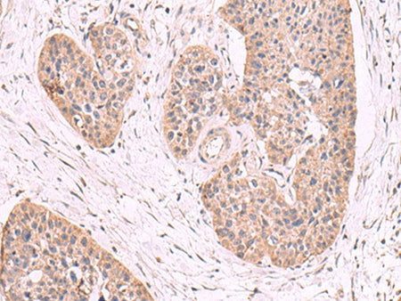 MGP Polyclonal Antibody Reactivity Human