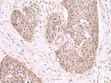 MGP Polyclonal Antibody Reactivity Human