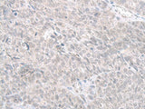 STAU2 Polyclonal Antibody Reactivity Human