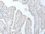 STAU2 Polyclonal Antibody Reactivity Human