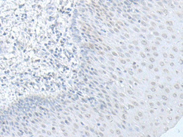 C8orf4 Polyclonal Antibody Reactivity Human