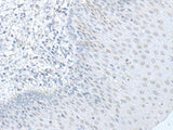 C8orf4 Polyclonal Antibody Reactivity Human