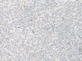 C8orf4 Polyclonal Antibody Reactivity Human