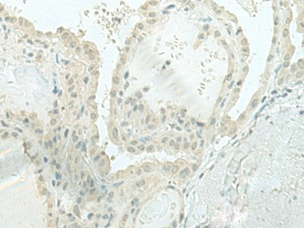 MIEN1 Polyclonal Antibody Reactivity Human