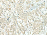 MIEN1 Polyclonal Antibody Reactivity Human