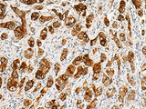 SAA1 Polyclonal Antibody Reactivity Human