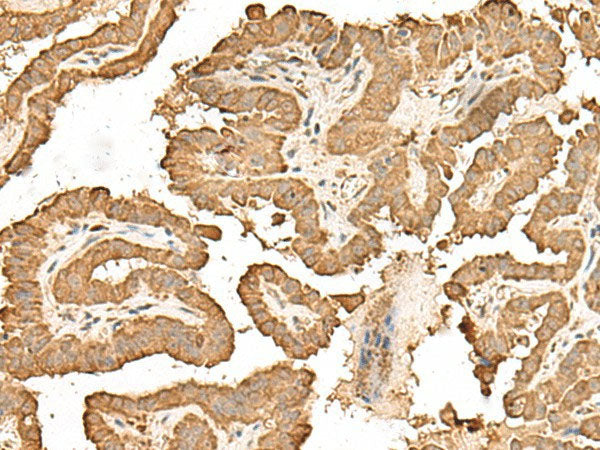 RPS25 Polyclonal Antibody Reactivity Human