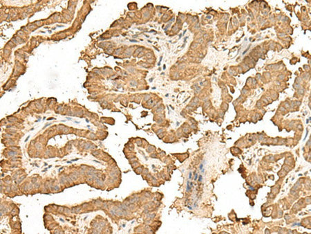 RPS25 Polyclonal Antibody Reactivity Human